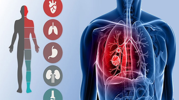 Pulmonology