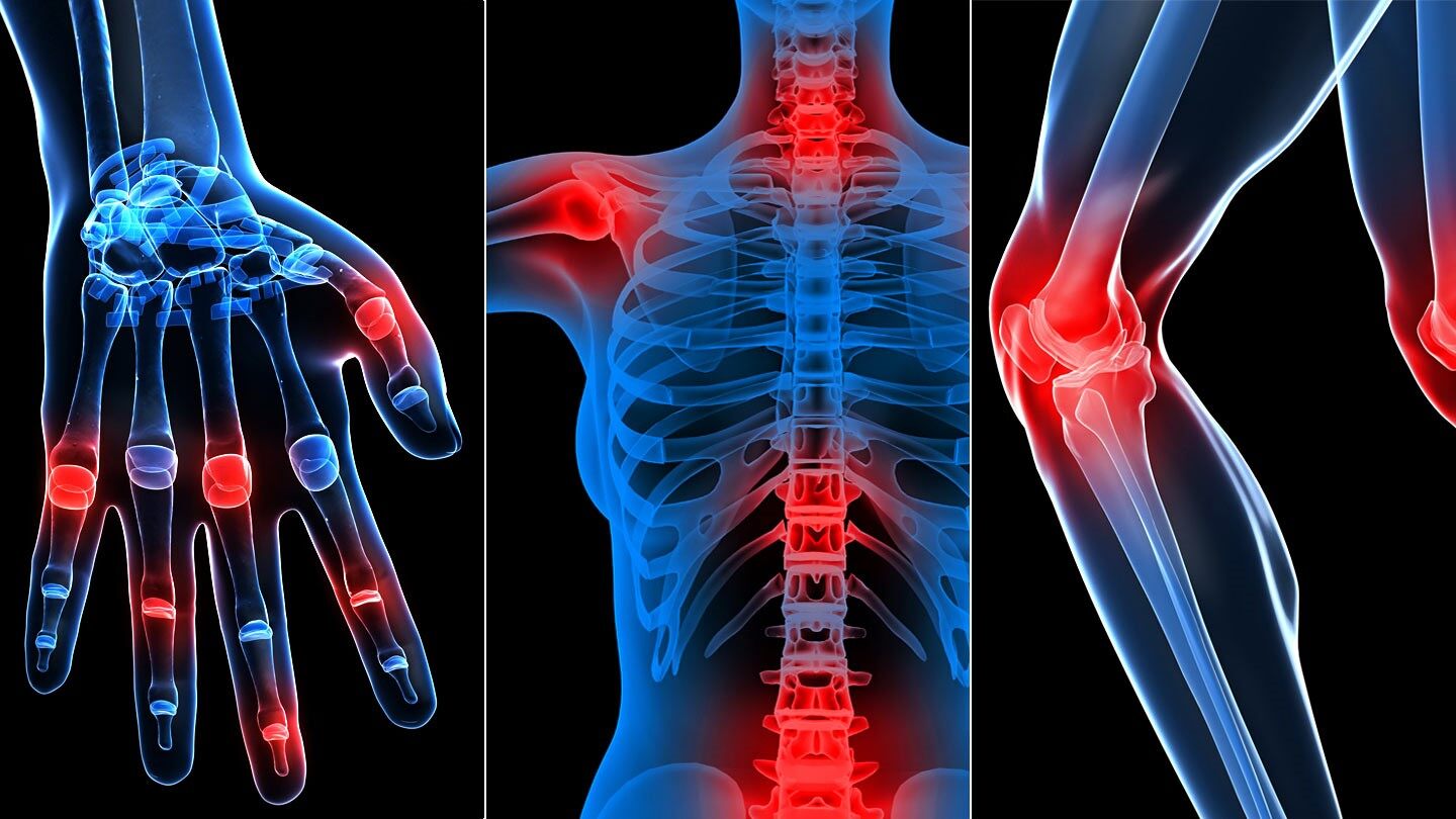 Rheumatology 